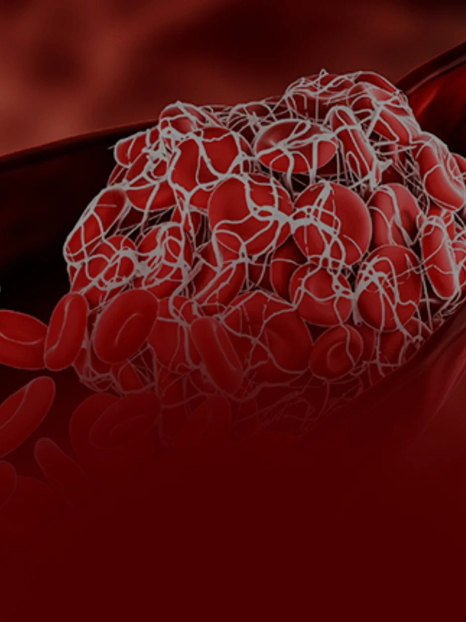 HEMOSTASIA E TROMBOSE - CBHL (CONGRESSO BRASILEIRO DE HEMATOLOGIA LABORATORIAL)
