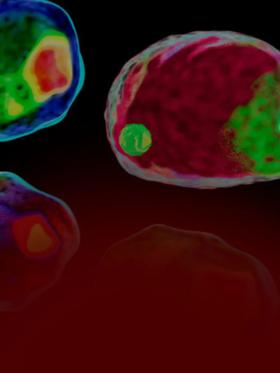 CITOMETRIA DE FLUXO - CBHL (CONGRESSO BRASILEIRO DE HEMATOLOGIA LABORATORIAL)