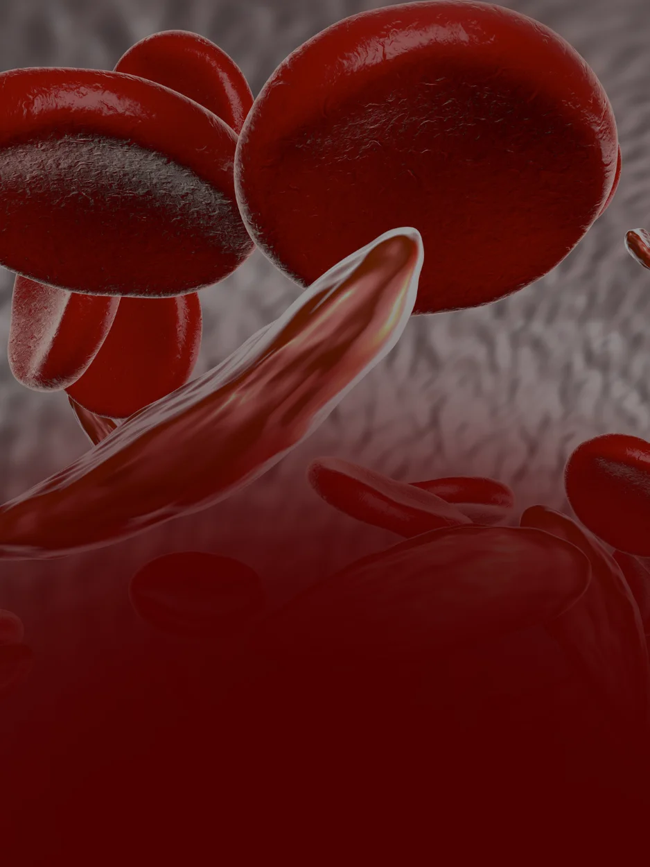 HEMOGLOBINOPATIAS - CBHL (CONGRESSO BRASILEIRO DE HEMATOLOGIA LABORATORIAL)