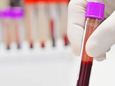 CBHL-Temas-8-qo7qd3mo9843x67cl08nwwgenzgbg1seimbaoddj94